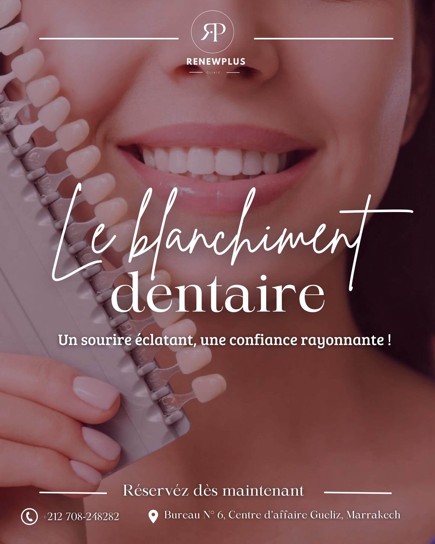 Blanchiment dentaire RenewPlus Clinic
